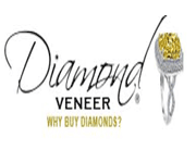 Diamond Veneer coupons